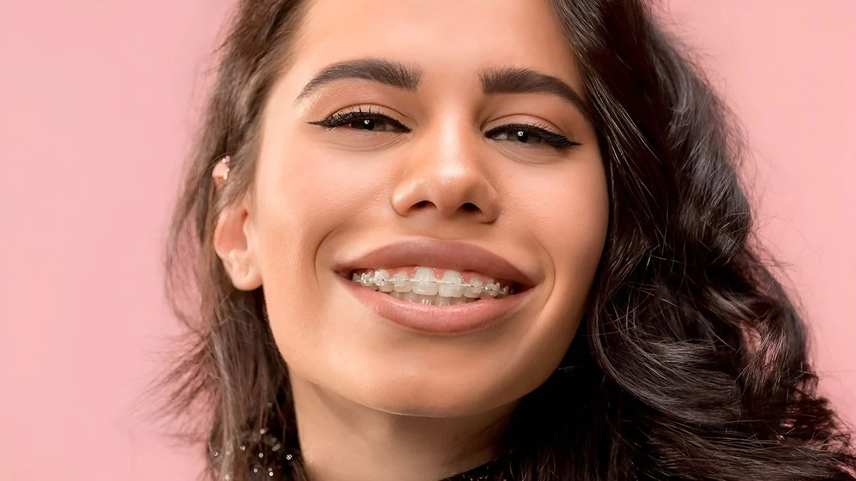 Ceramic Braces - Image 4