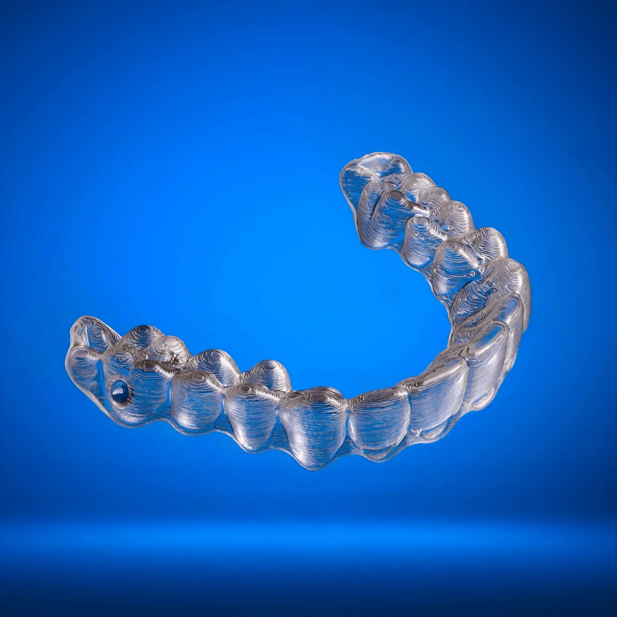 Invisalign Treatment - Image 5