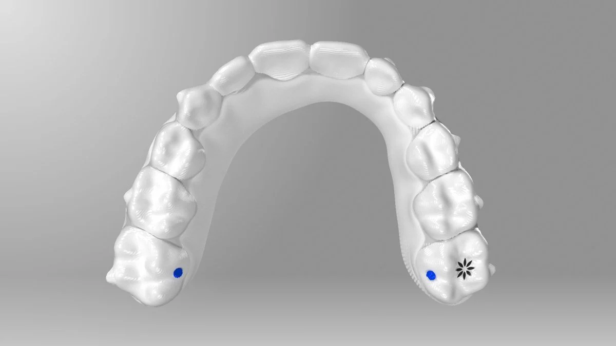 Invisalign Treatment - Image 6
