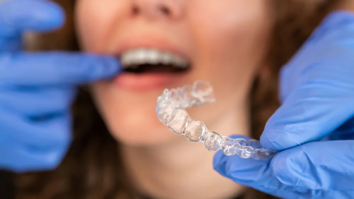 Invisalign Treatment - Image 8