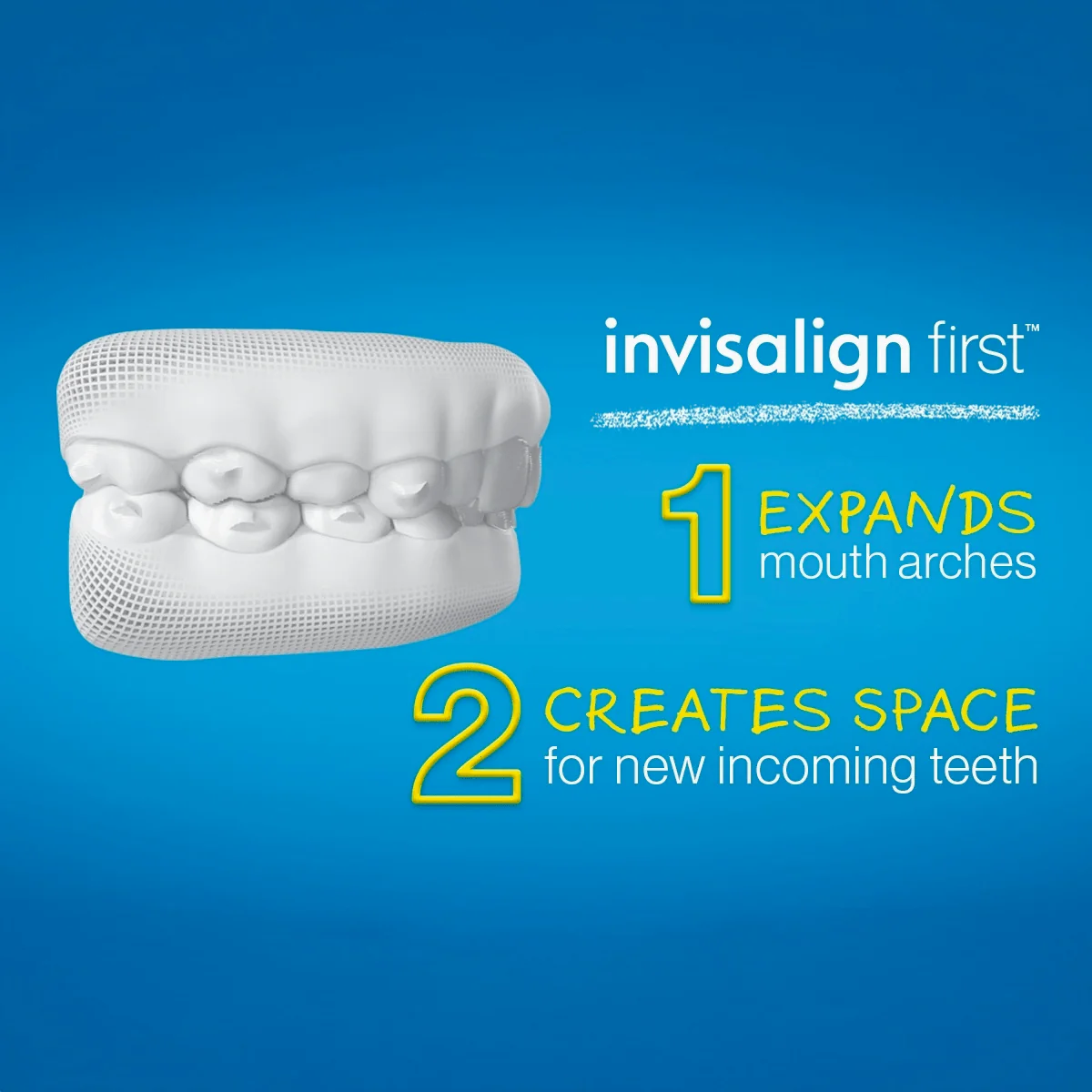 Invisalign for Kids - Image 3