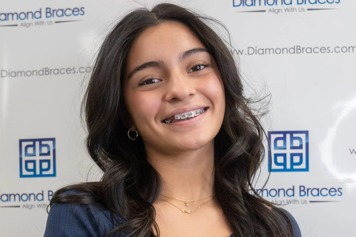 Metal Braces - Image 6
